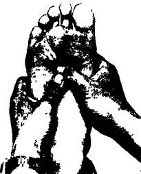 Рис. 23. Массаж точки Юн-цюань (111).