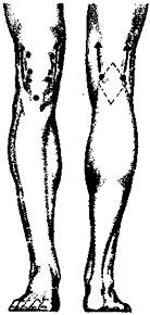 Рис. 29. Массаж точек Ци-янь (103), Чэн-гу (104).