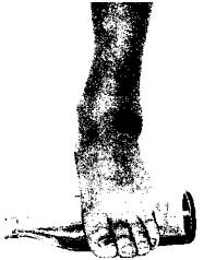Рис. 55. Массаж подошвы ноги с помощью бутылки.