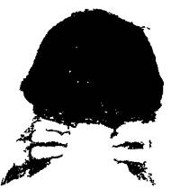 Рис. 78. Массаж точек методом шиацу при фригидности